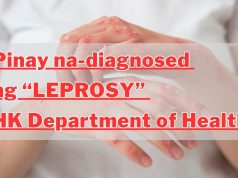 Pinay na-diagnosed ng “Leprosy”, HK Department of Health Pinay na-diagnosed ng “Leprosy”, HK Department of Health