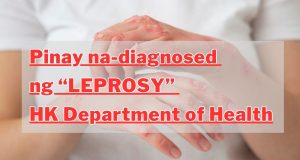 Pinay na-diagnosed ng “Leprosy”, HK Department of Health Pinay na-diagnosed ng “Leprosy”, HK Department of Health